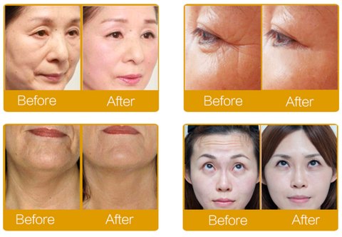 24K Gold Anti-Wrinkle Essence BUY TWO GET ONE FREE